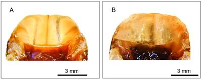 Relationship between flight muscle dimorphism and wing morphometry in Triatoma infestans (Klug, 1834) (Hemiptera, Reduviidae, Triatominae)